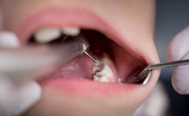 Dentist Hagerstown: Dental Education Events in Hagerstown